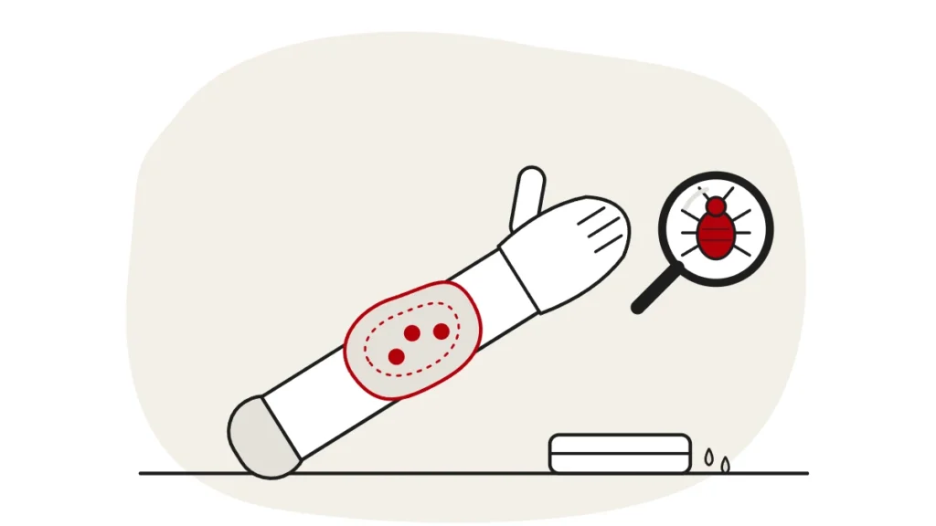 Illustration of a forearm with a swollen red area around bed bug bites and a damp cloth, with a bed bug under a magnifying glass