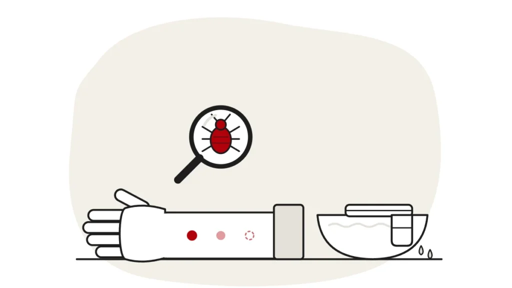 Illustration of a forearm with fading bed bug bites and a bowl with a damp cloth, with a bed bug under a magnifying glass
